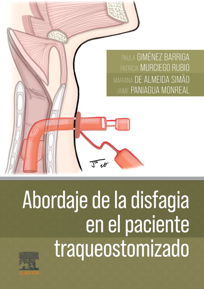 ABORDAJE DE LA DISFAGIA EN EL PACIENTE TRAQUEOSTOMIZADO - 9788413824949