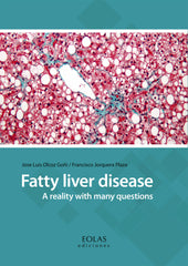 FATTY LIVER DISEASE - 9788416613977