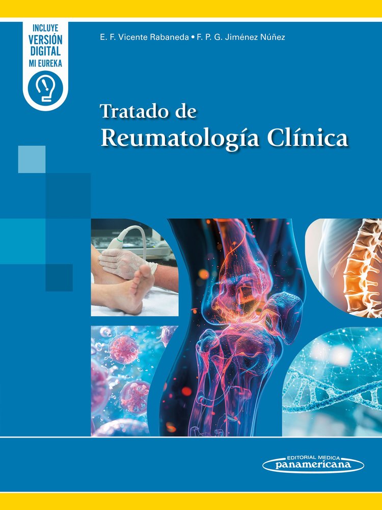 TRATADO DE REUMATOLOGIA CLINICA - 9788411061728