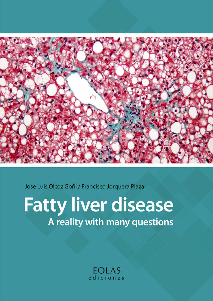 FATTY LIVER DISEASE - 9788416613977 Imagen principal del producto