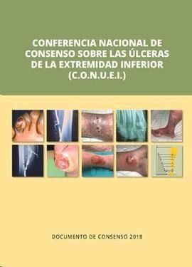 CONFERENCIA NACIONAL CONSENSO SOBRE ULCERAS DE LA EX - 9788417194260 Imagen principal del producto