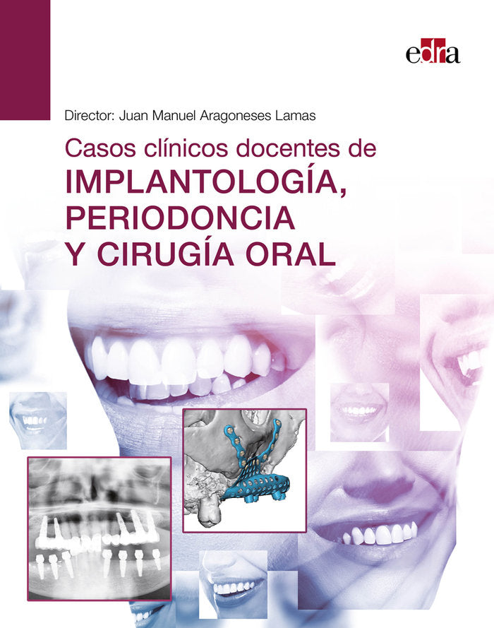 CASOS CLINICOS DOCENTES DE IMPLANTOLOGIA PERIODONCIA Y CIRU - 9788418706554 Imagen principal del producto