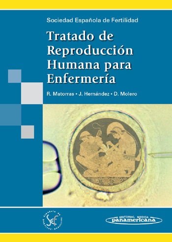 TRATADO DE REPRODUCCION HUMANA PARA ENFERMERIA - 9788479032937