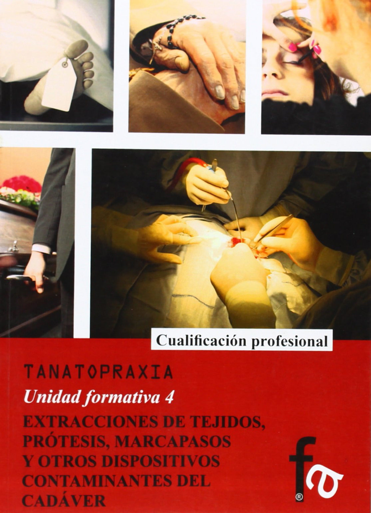 Estracciones de Tejidos, Protesis, Marcapasos y Otros Dispositivos Contaminantes del Cadaver