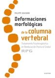 DEFORMACIONES MORFOLOGICAS DE LA COLUMNA VERTEBRAL - 9788491130635 Imagen principal del producto