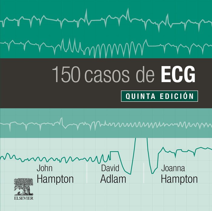 150 CASOS DE ECG - 9788491135043 Imagen principal del producto