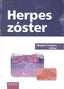 HERPES ZOSTER - 9788492442812