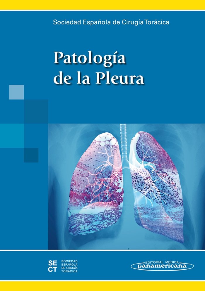 PATOLOGIA DE LA PLEURA - 9788498357929 Imagen principal del producto