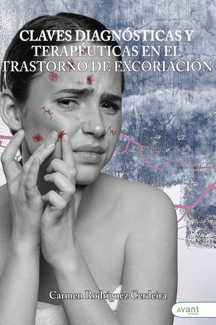 CLAVES DIAGNOSTICAS Y TERAPEUTICAS EN EL TRASTORNO DE EXCOR - 9791387532215 Imagen principal del producto