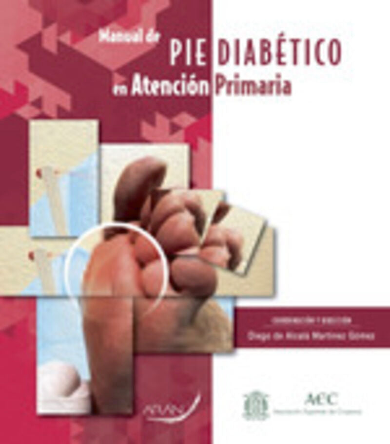 Manual de cuidados del pie diabético en Atención primaria